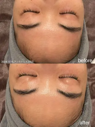 マツエク・マツパ 小顔＆まつ毛サロン AKANE❤️のエステ・リラクイメージ