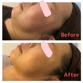 痩身専門サロン ビューティーグランツのエステ・リラクイメージ