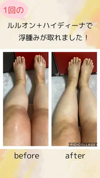 YOSAPARK Leapのエステ・リラクイメージ