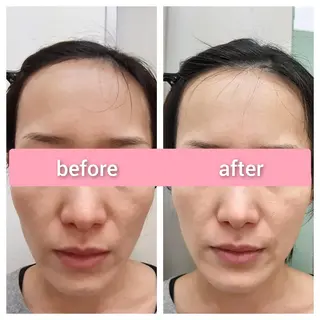 デ・アイム王寺所属・たるみ解消エミリーノ 米田真美子のエステ・リラクイメージ