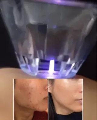 エイジングケアサロンBIOEL所属・肌質改善BIOELプ ラズマ/ラミピールのエステ・リラクイメージ