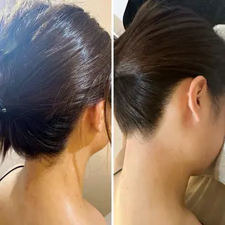 うなじ脱毛/美肌脱毛 LABELのエステ・リラクイメージ