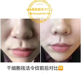 aliaハイフ&水光ジェットサロン所属・aliaハーブ水光店 エステティシャン募集のエステ・リラクイメージ