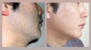 フェイシャルサロン shamrockのエステ・リラクイメージ