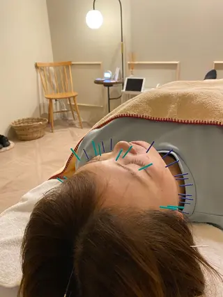 美容鍼/ヘッドスパ/ 💎さかもとのエステ・リラクイメージ