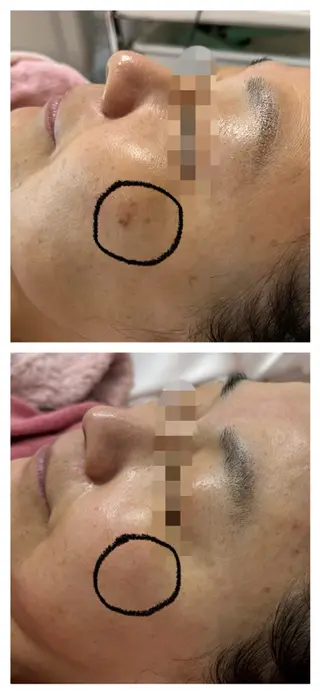 顔専門エステ プリエールビューティのエステ・リラクイメージ