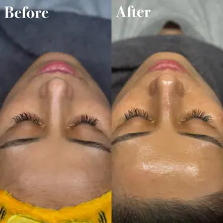 眉毛と韓国肌質改善 サロン　和泉府中のエステ・リラクイメージ