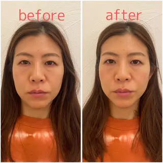 美容鍼サロンメゾンブランシェ所属・🌸美容鍼サロン🌸 メゾンブランシェ🌈のエステ・リラクイメージ