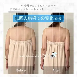 【頭痛、睡眠改善】 salon RUUのエステ・リラクイメージ