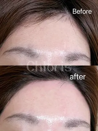 川越ローマピンク 光脱毛＆ワックス脱毛のエステ・リラクイメージ