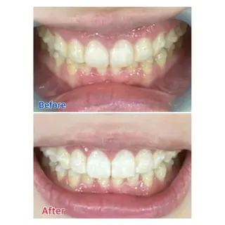 M渋谷店所属・Ｍ渋谷 ホワイトニングのその他イメージ