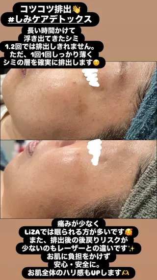 LiZA エステティックサロンのエステ・リラクイメージ