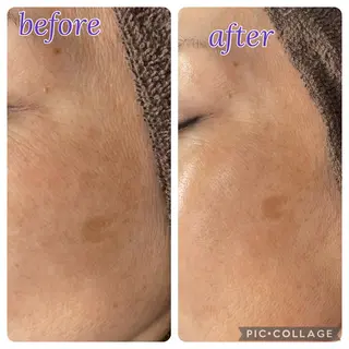 total beauty  salon RIRE所属・古川 弥生のエステ・リラクイメージ