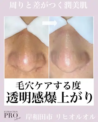 毛穴汚れ改善専門店/ 岸和田/リヒオルオルのエステ・リラクイメージ