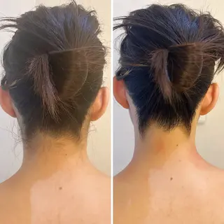 うなじ脱毛/美肌脱毛 LABELのエステ・リラクイメージ