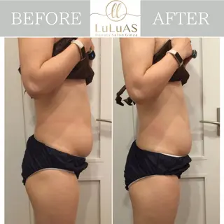 ルルアス GINZAのエステ・リラクイメージ