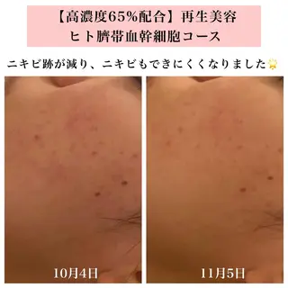 Bellesthe (ベルエステ)のエステ・リラクイメージ