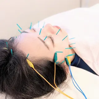 小顔美容鍼灸Acubelle Yakuin.【アキュベル薬院】所属・石川 真梨奈  美容鍼灸/アロマのエステ・リラクイメージ