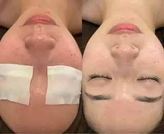 oyam オヤムのエステ・リラクイメージ