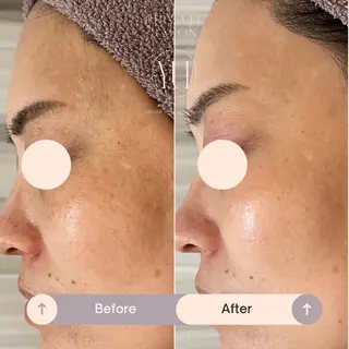 1ヶ月後も半分残る 高持続LEDエクステのマツエク・マツパデザイン