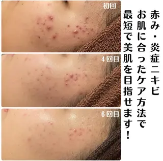 LutanRiche青森店所属・ルタンリッシュ 青森店のエステ・リラクイメージ