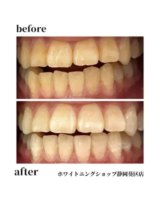 ホワイトニングショップ静岡葵区店所属・ホワイトニング ショップ葵区静岡駅店のその他イメージ