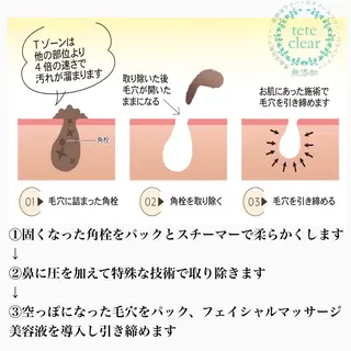 【しみ毛穴専門店】beautysalon Ankh所属・しみ毛穴専門店 Ankh 平田のエステ・リラクイメージ