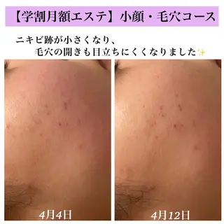 Bellesthe （ベルエステ）のエステ・リラクイメージ