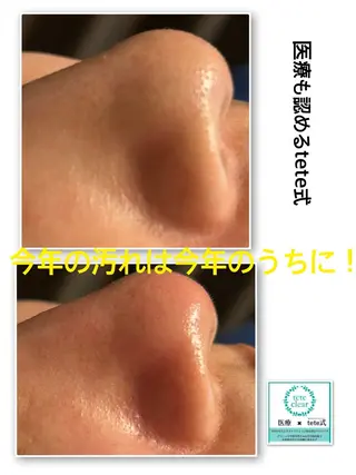 リフュージュ所属・リフュージュ隠れ家 八王子の眉毛・アイブロウイメージ