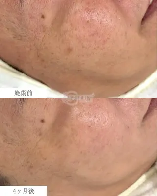 美の宝石屋さん gemme【ジェム】所属・gemme -ジェム-のエステ・リラクイメージ