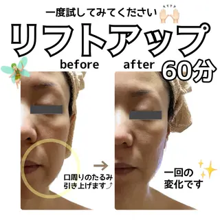 stella所属・stella都度払い 痩身小顔まつげパーマのマツエク・マツパデザイン