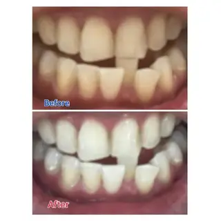 M渋谷店所属・M渋谷 ホワイトニングのエステ・リラクイメージ