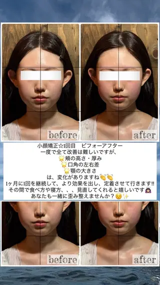 💎後悔させない小顔 矯正💎イトヤマ🌱のエステ・リラクイメージ