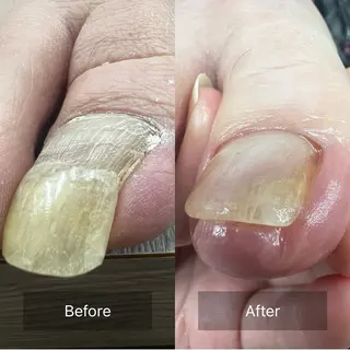 ネイル Belulu所属・Belulu ベルルのネイルデザイン