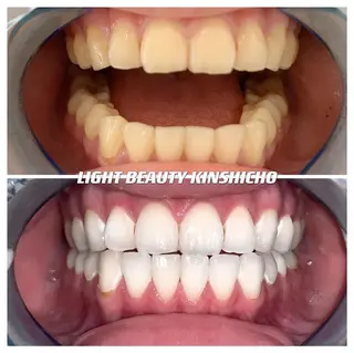 メンズ ライトビューティー 錦糸町店のエステ・リラクイメージ