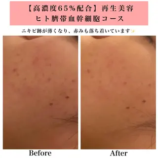 Bellesthe （ベルエステ）のエステ・リラクイメージ