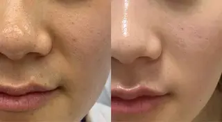 ネイル 愛維美水光美肌専門店所属・愛維美水光美肌専門店 メンズレディースokのエステ・リラクイメージ