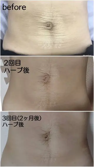 オールハンド フェイシャルのエステ・リラクイメージ