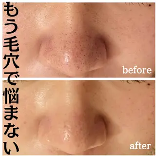 フェイシャル専門サロ ン　ERINのエステ・リラクイメージ