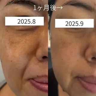 Del'm豊橋所属・豊橋De'Im 安部のエステ・リラクイメージ