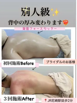 ブライダル痩身×脱毛 尼崎駅前サロンのエステ・リラクイメージ