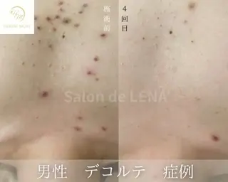 Grandir所属・ハーブピーリング専門 グランディール　武内のエステ・リラクイメージ