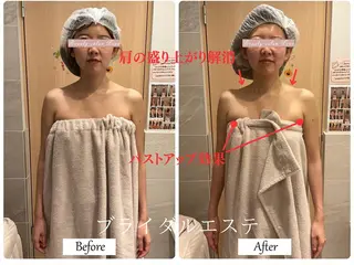 ブライダルサロン ｜Lino【堀江】のエステ・リラクイメージ