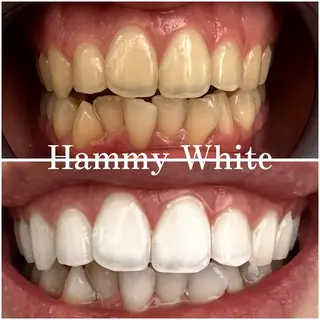 Hammy White所属・HammyWhite 🍬Renaの眉毛・アイブロウイメージ