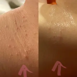 Mandarin Orange所属・毛穴から始める肌メン テマンダリンオレンジのエステ・リラクイメージ