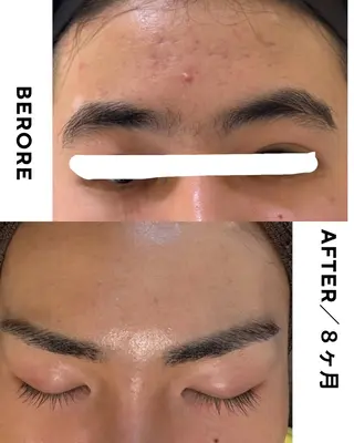 メンズ アイブロウ ヤスダ ユウコのエステ・リラクイメージ