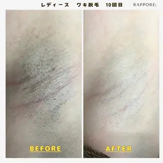 Rappore; 心斎橋 みずきのエステ・リラクイメージ