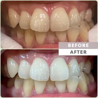 easy whitening 新宿店所属・イージーホワイト ニング　新宿店のエステ・リラクイメージ