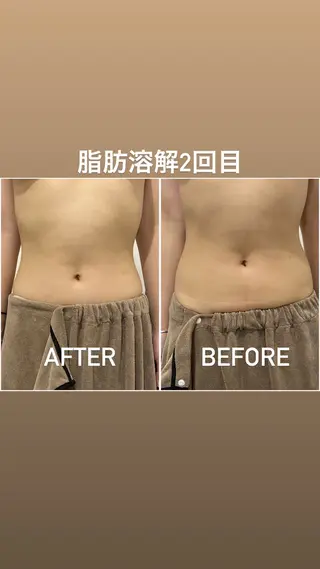 毛穴洗浄・痩身・脱毛 /アルカンジュのエステ・リラクイメージ