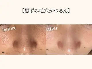 毛穴ケア専門サロン＆ドライヘッドスパ【毛穴洗浄 | ララピール】DREAM SPA町田店所属・小顔矯正×毛穴サロン DRRAMSPA町田のエステ・リラクイメージ